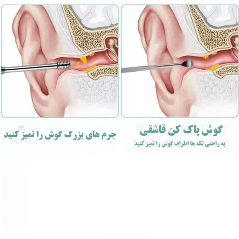 مجموعه نظافت گوش مدل EarCare-10 بسته 6 عددی
